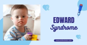 Edward Syndrome in Biological Anthropology