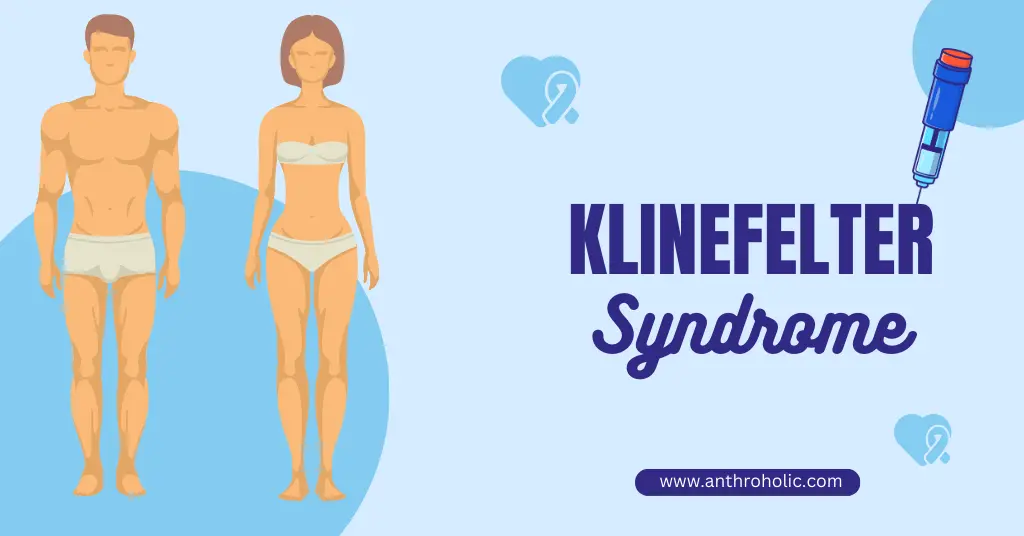 klinefelter syndrome in female